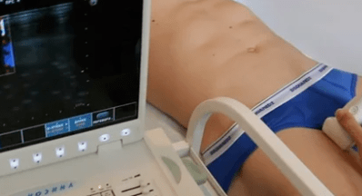 Apatinių galūnių varikozinių venų diagnostinės galimybės